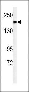 A2ML1 Antibody - Western blot of A2ML1 Antibody in mouse lung tissue lysates (35 ug/lane). A2ML1 (arrow) was detected using the purified antibody.