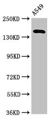 A2ML1 Antibody - Western Blot Positive WB detected in:A549 whole cell lysate All Lanes:A2ML1 antibody at 3.2µg/ml Secondary Goat polyclonal to rabbit IgG at 1/50000 dilution Predicted band size: 162,106 KDa Observed band size: 162 KDa