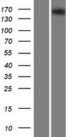 A2ML1 Protein - Western validation with an anti-DDK antibody * L: Control HEK293 lysate R: Over-expression lysate