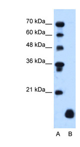A4 / PLP2 Antibody - PLP2 antibody ARP45348_T100-NP_002659-PLP2(proteolipid protein 2 (colonic epithelium-enriched)) Antibody Western blot of HepG2 cell lysate.  This image was taken for the unconjugated form of this product. Other forms have not been tested.