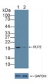 A4 / PLP2 Antibody - Knockout Varification: Lane 1: Wild-type Hela cell lysate; Lane 2: PLP2 knockout Hela cell lysate; Predicted MW: 16kd Observed MW: 19kd Primary Ab: 1µg/ml Rabbit Anti-Human PLP2 Antibody Second Ab: 0.2µg/mL HRP-Linked Caprine Anti-Rabbit IgG Polyclonal Antibody
