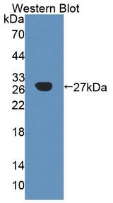 A4GALT Antibody - Western Blot; Sample: Recombinant protein.