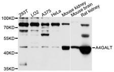 A4GALT Antibody - Western blot analysis of extracts of various cell lines.