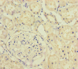 A4GALT Antibody - Immunohistochemistry of paraffin-embedded human kidney tissue at dilution of 1:100