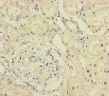 A4GALT Antibody - Immunohistochemistry of paraffin-embedded human kidney tissue at dilution of 1:100