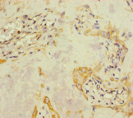 A4GALT Antibody - Immunohistochemistry of paraffin-embedded human placenta tissue at dilution of 1:100
