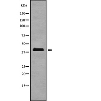 A4GALT Antibody - Western blot analysis of A4GALT using K562 whole cells lysates