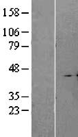 A4GALT Protein - Western validation with an anti-DDK antibody * L: Control HEK293 lysate R: Over-expression lysate