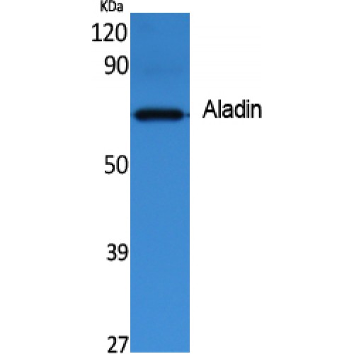 AAAS / Adracalin Antibody - Western blot of Aladin antibody