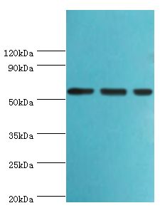 AAAS / Adracalin Antibody - Western blot. All lanes: Aladin antibody at 5 ug/ml. Lane 1: HeLa whole cell lysate. Lane 2: mouse brain tissue. Lane 3: NIH3T3 whole cell lysate. Secondary antibody: Goat polyclonal to rabbit at 1:10000 dilution. Predicted band size: 60 kDa. Observed band size: 60 kDa.