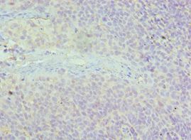 AAAS / Adracalin Antibody - Immunohistochemistry of paraffin-embedded human tonsil using antibody at 1:100 dilution.