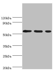 AAAS / Adracalin Antibody - Western blot All lanes: Aladin antibody at 5µg/ml Lane 1: Hela whole cell lysate Lane 2: Mouse brain tissue Lane 3: NIH/3T3 whole cell lysate Secondary Goat polyclonal to rabbit IgG at 1/10000 dilution Predicted band size: 60, 56 kDa Observed band size: 60 kDa