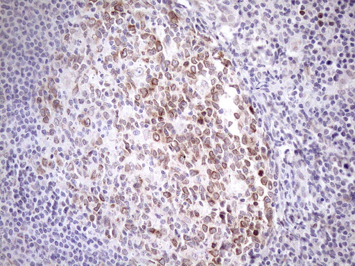 AAAS / Adracalin Antibody - Immunohistochemical staining of paraffin-embedded Human tonsil within the normal limits using anti-AAAS mouse monoclonal antibody. (Heat-induced epitope retrieval by 1mM EDTA in 10mM Tris buffer. (pH8.5) at 120°C for 3 min. (1:150)