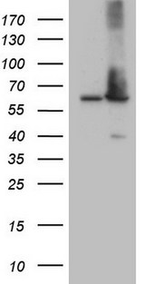 AAAS / Adracalin Antibody - HEK293T cells were transfected with the pCMV6-ENTRY control. (Left lane) or pCMV6-ENTRY AAAS. (Right lane) cDNA for 48 hrs and lysed