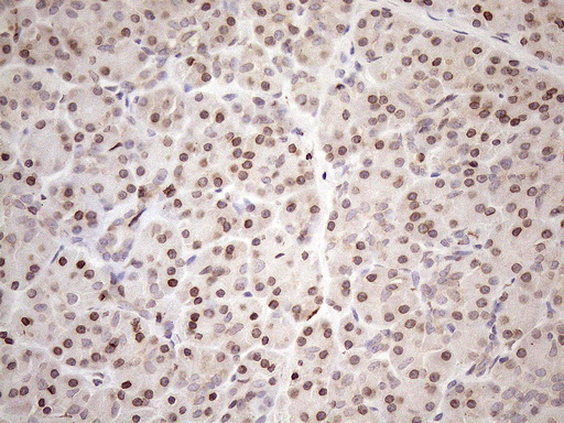 AAAS / Adracalin Antibody - Immunohistochemical staining of paraffin-embedded Human pancreas tissue within the normal limits using anti-AAAS mouse monoclonal antibody. (Heat-induced epitope retrieval by 1mM EDTA in 10mM Tris buffer. (pH8.5) at 120°C for 3 min. (1:150)