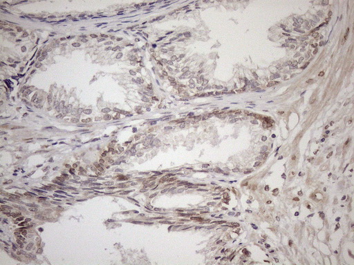 AAAS / Adracalin Antibody - Immunohistochemical staining of paraffin-embedded Human prostate tissue within the normal limits using anti-AAAS mouse monoclonal antibody. (Heat-induced epitope retrieval by 1mM EDTA in 10mM Tris buffer. (pH8.5) at 120°C for 3 min. (1:150)