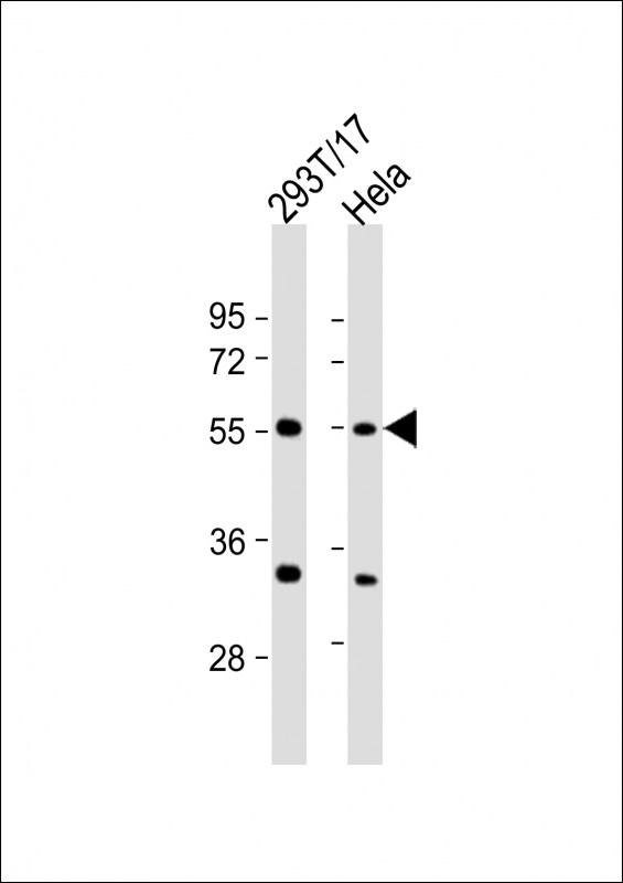 AAAS / Adracalin Antibody - All lanes: Anti-AAAS Antibody (C-Term) at 1:2000 dilution. Lane 1: 293T/17 whole cell lysate. Lane 2: HeLa whole cell lysate Lysates/proteins at 20 ug per lane. Secondary Goat Anti-Rabbit IgG, (H+L), Peroxidase conjugated at 1:10000 dilution. Predicted band size: 60 kDa. Blocking/Dilution buffer: 5% NFDM/TBST.