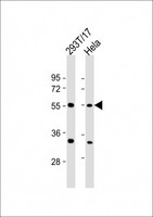 AAAS / Adracalin Antibody - All lanes: Anti-AAAS Antibody (C-Term) at 1:2000 dilution. Lane 1: 293T/17 whole cell lysate. Lane 2: HeLa whole cell lysate Lysates/proteins at 20 ug per lane. Secondary Goat Anti-Rabbit IgG, (H+L), Peroxidase conjugated at 1:10000 dilution. Predicted band size: 60 kDa. Blocking/Dilution buffer: 5% NFDM/TBST.