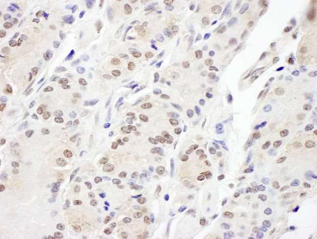 AAAS / Adracalin Antibody - Detection of human Aladin by immunohistochemistry. Sample: FFPE section of human stomach. Antibody: Affinity purified rabbit anti- Aladin used at a dilution of 1:1,000 (1µg/ml). Detection: DAB