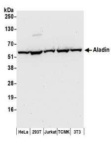 AAAS / Adracalin Antibody - Detection of human and mouse Aladin by western blot. Samples: Whole cell lysate (50 µg) from HeLa, HEK293T, Jurkat, mouse TCMK-1, and mouse NIH 3T3 cells prepared using NETN lysis buffer. Antibodies: Affinity purified rabbit anti-Aladin antibody used for WB at 0.1 µg/ml. Detection: Chemiluminescence with an exposure time of 30 seconds.