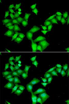 AAAS / Adracalin Antibody - Immunofluorescence analysis of HeLa cells.