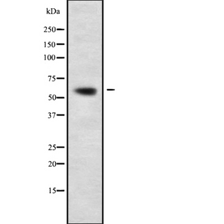 AAAS / Adracalin Antibody - Western blot analysis of AAAS using Jurkat whole cells lysates