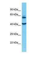 AAAS / Adracalin Antibody - Western blot of AAAS Antibody with human OVCAR-3 Whole Cell lysate.  This image was taken for the unconjugated form of this product. Other forms have not been tested.
