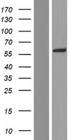 AAAS / Adracalin Protein - Western validation with an anti-DDK antibody * L: Control HEK293 lysate R: Over-expression lysate