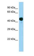 AACS Antibody - AACS antibody Western Blot of Rat Muscle.  This image was taken for the unconjugated form of this product. Other forms have not been tested.