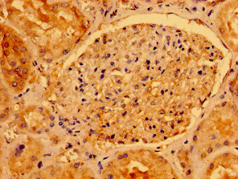 AACS Antibody - Immunohistochemistry image of paraffin-embedded human kidney tissue at a dilution of 1:100