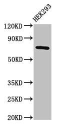 AACS Antibody - Positive Western Blot detected in HEK293 whole cell lysate. All lanes: AACS antibody at 2.5 µg/ml Secondary Goat polyclonal to rabbit IgG at 1/50000 dilution. Predicted band size: 76, 68, 31 KDa. Observed band size: 76 KDa