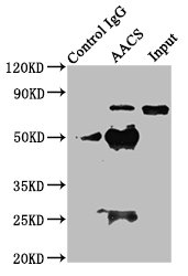 AACS Antibody - Immunoprecipitating AACS in HEK293 whole cell lysate Lane 1: Rabbit control IgG instead of AACS Antibody in HEK293 whole cell lysate.For western blotting, a HRP-conjugated Protein G antibody was used as the secondary antibody (1/2000) Lane 2: AACS Antibody (8µg) + HEK293 whole cell lysate (500µg) Lane 3: HEK293 whole cell lysate (10µg)