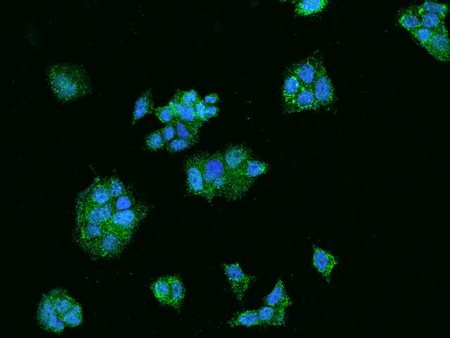 AACS Antibody - Immunofluorescence staining of AACS in MCF7 cells. Cells were fixed with 4% PFA, permeabilzed with 0.1% Triton X-100 in PBS, blocked with 10% serum, and incubated with rabbit anti-Human AACS polyclonal antibody (dilution ratio 1:200) at 4°C overnight. Then cells were stained with the Alexa Fluor 488-conjugated Goat Anti-rabbit IgG secondary antibody (green) and counterstained with DAPI (blue). Positive staining was localized to Cytoplasm.