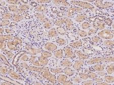 AACS Antibody - Immunochemical staining of human AACS in human kidney with rabbit polyclonal antibody at 1:100 dilution, formalin-fixed paraffin embedded sections.