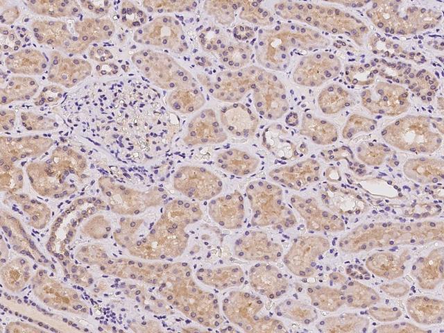 AACS Antibody - Immunochemical staining of human AACS in human kidney with rabbit polyclonal antibody at 1:100 dilution, formalin-fixed paraffin embedded sections.