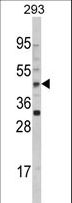 AADAC Antibody - Western blot of AADAC Antibody in 293 cell line lysates (35 ug/lane). AADAC (arrow) was detected using the purified antibody.