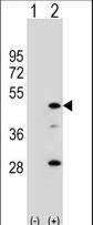 AADAC Antibody - Western blot of AADAC (arrow) using rabbit polyclonal AADAC Antibody. 293 cell lysates (2 ug/lane) either nontransfected (Lane 1) or transiently transfected (Lane 2) with the AADAC gene.