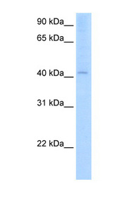 AADAC Antibody - AADAC antibody ARP45038_T100-NP_001077-AADAC(arylacetamide deacetylase (esterase)) Antibody Western blot of Fetal Liver lysate.  This image was taken for the unconjugated form of this product. Other forms have not been tested.
