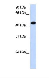 AADAC Antibody - Transfected 293T cell lysate. Antibody concentration: 1.0 ug/ml. Gel concentration: 12%.  This image was taken for the unconjugated form of this product. Other forms have not been tested.