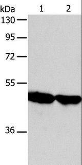 AADAC Antibody - Western blot analysis of Human fetal liver and liver cancer tissue, using AADAC Polyclonal Antibody at dilution of 1:600.