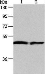 AADAC Antibody - Western blot analysis of Human fetal liver and liver cancer tissue, using AADAC Polyclonal Antibody at dilution of 1:550.