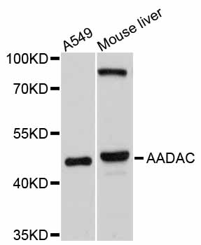 AADAC Antibody - Western blot analysis of extracts of various cell lines, using AADAC antibody at 1:1000 dilution. The secondary antibody used was an HRP Goat Anti-Rabbit IgG (H+L) at 1:10000 dilution. Lysates were loaded 25ug per lane and 3% nonfat dry milk in TBST was used for blocking. An ECL Kit was used for detection and the exposure time was 30s.