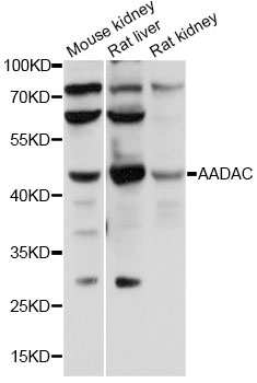 AADAC Antibody - Western blot analysis of extracts of various cell lines, using AADAC antibody at 1:1000 dilution. The secondary antibody used was an HRP Goat Anti-Rabbit IgG (H+L) at 1:10000 dilution. Lysates were loaded 25ug per lane and 3% nonfat dry milk in TBST was used for blocking. An ECL Kit was used for detection and the exposure time was 20s.