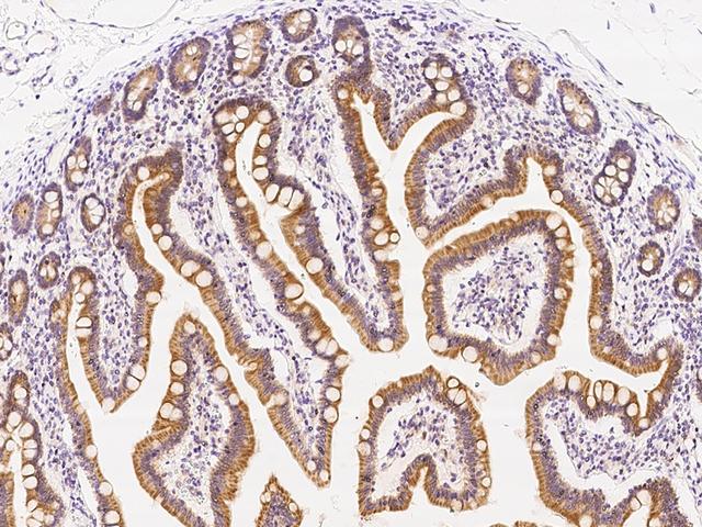 AADAC Antibody - Immunochemical staining of human AADAC in human duodenum with rabbit polyclonal antibody at 1:300 dilution, formalin-fixed paraffin embedded sections.