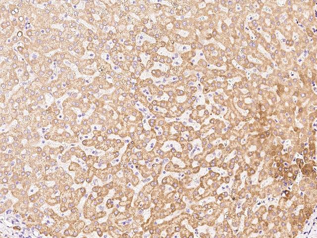 AADAC Antibody - Immunochemical staining of human AADAC in human liver with rabbit polyclonal antibody at 1:300 dilution, formalin-fixed paraffin embedded sections.