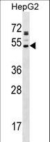 AADACL2 Antibody - AADACL2 Antibody western blot of HepG2 cell line lysates (35 ug/lane). The AADACL2 antibody detected the AADACL2 protein (arrow).