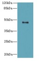AADACL2 Antibody - Western blot. All lanes: AADACL2 antibody at 2 ug/ml3 whole cell lysate Goat polyclonal to rabbit at 1:10000 dilution. Predicted band size: 46 kDa. Observed band size: 46 kDa.