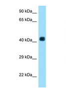 AADACL3 Antibody - AADACL3 antibody Western blot of HeLa Cell lysate. Antibody concentration 1 ug/ml.  This image was taken for the unconjugated form of this product. Other forms have not been tested.