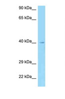 AADACL3 Antibody - AADACL3 antibody Western blot of HepG2 Cell lysate. Antibody concentration 1 ug/ml.  This image was taken for the unconjugated form of this product. Other forms have not been tested.