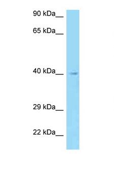 AADACL3 Antibody - AADACL3 antibody Western blot of HepG2 Cell lysate. Antibody concentration 1 ug/ml.  This image was taken for the unconjugated form of this product. Other forms have not been tested.